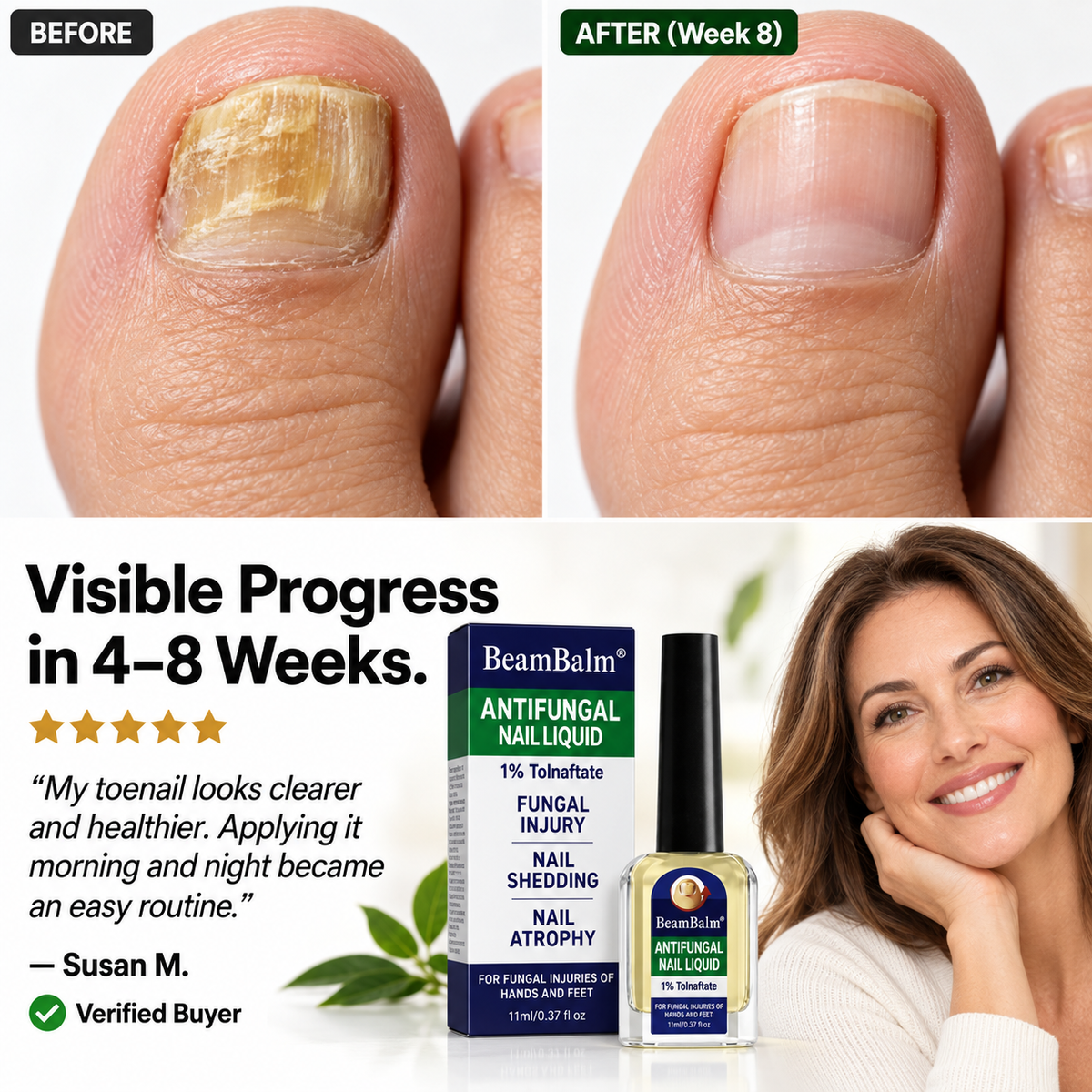 BeamBalm® Antifungal Nail Liquid – 1% Tolnaftate Targeted Nail Care – Precision Brush for Hands & Feet, 11 ml