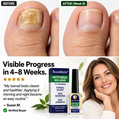 BeamBalm® Antifungal Nail Liquid – 1% Tolnaftate Targeted Nail Care – Precision Brush for Hands & Feet, 11 ml