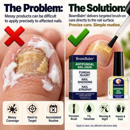 BeamBalm® Antifungal Nail Liquid – 1% Tolnaftate Targeted Nail Care – Precision Brush for Hands & Feet, 11 ml