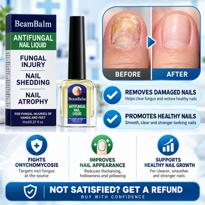 BeamBalm® Solución de Tolnaftato para Hongos en las Uñas