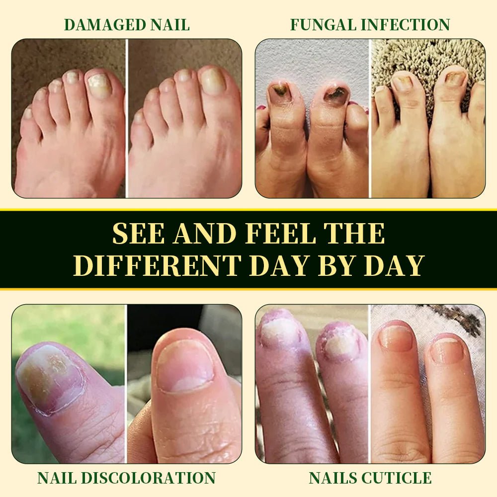 BeamBalm® Antifungal Foot Soak Pack | Triple Action Foot Soak | 20 Herbal Packs