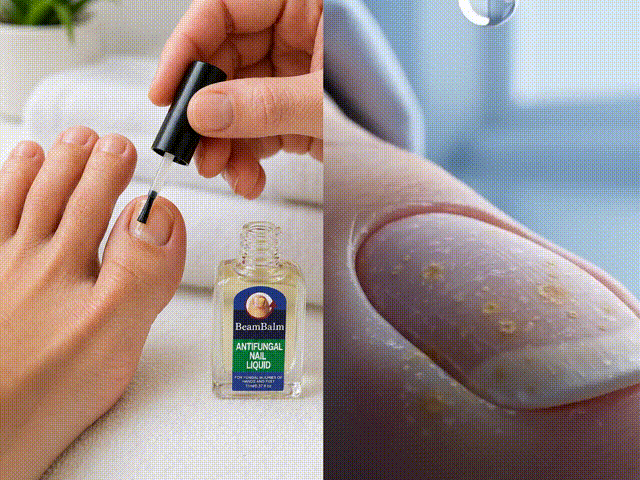 How to apply BeamBalm antifungal nail liquid